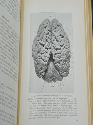 The Gross and Minute Anatomy of the Central Nervous System